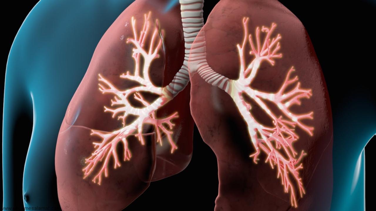 COPD- بیماری انسداد مزمن ریوی