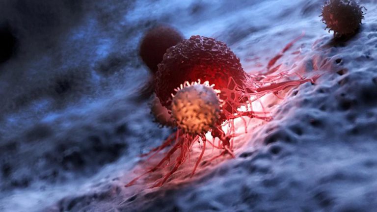 اسید های چرب امگا 3 ممکن است به پیشگیری از سرطان کمک کنند